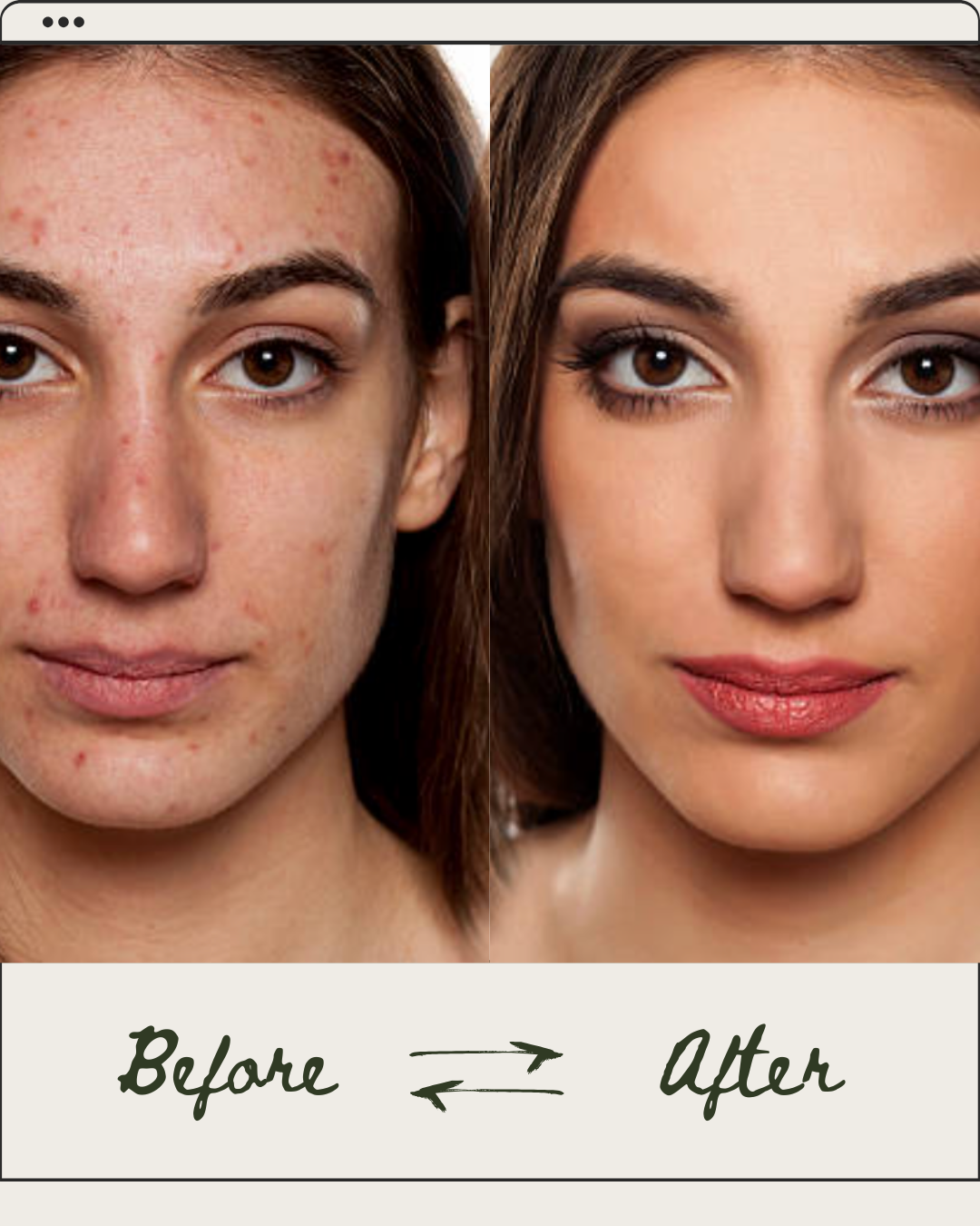 Whipped Tallow & Honey Balm - Natural Skin Repair